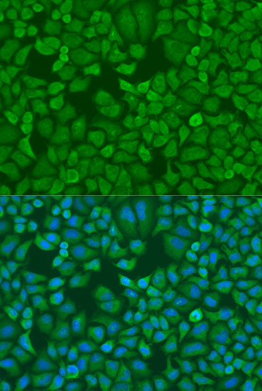 Immunofluorescence analysis of U2OS cells using IGF2BP1 Polyclonal Antibody at dilution of  1:100. Blue: DAPI for nuclear staining.