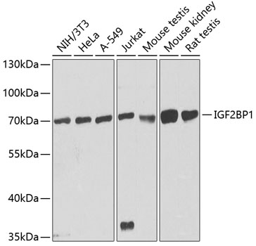 Western blot analysis of extracts of various cell lines using IGF2BP1 Polyclonal Antibody at dilution of 1:1000.