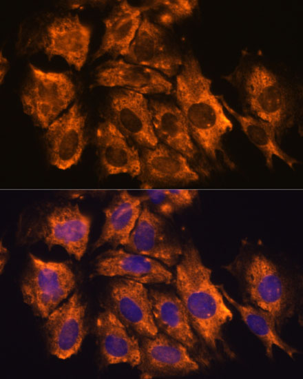 Immunofluorescence analysis of C6 cells using CRELD1 Polyclonal Antibody at dilution of  1:100. Blue: DAPI for nuclear staining.