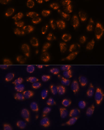 Immunofluorescence analysis of HeLa cells using CRELD1 Polyclonal Antibody at dilution of  1:100. Blue: DAPI for nuclear staining.