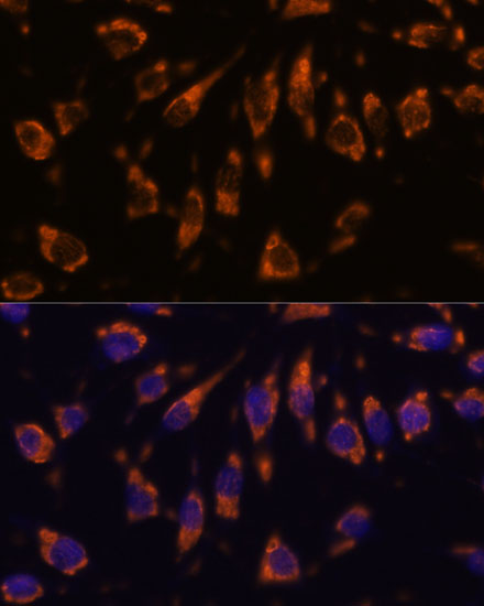 Immunofluorescence analysis of L929 cells using CRELD1 Polyclonal Antibody at dilution of  1:100. Blue: DAPI for nuclear staining.