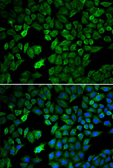 Immunofluorescence analysis of U2OS cells using PRMT5 Polyclonal Antibody