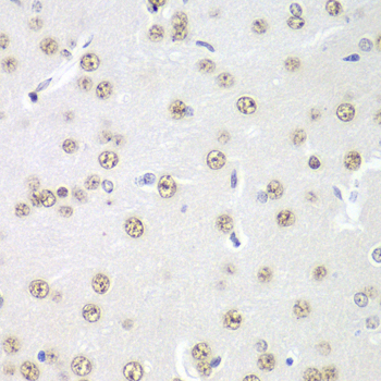 Immunohistochemistry of paraffin-embedded Rat brain using PRMT5 Polyclonal Antibody at dilution of  1:100 (40x lens).