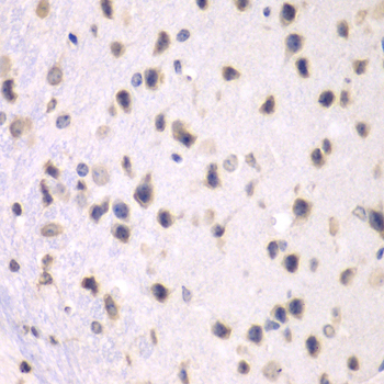 Immunohistochemistry of paraffin-embedded Mouse brain using PRMT5 Polyclonal Antibody at dilution of  1:100 (40x lens).