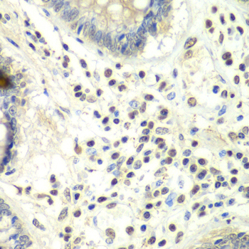 Immunohistochemistry of paraffin-embedded Human colon using PRMT5 Polyclonal Antibody at dilution of  1:100 (40x lens).