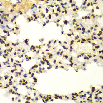 Immunohistochemistry of paraffin-embedded Mouse lung using SUMO2 Polyclonal Antibody at dilution of  1:100 (40x lens).