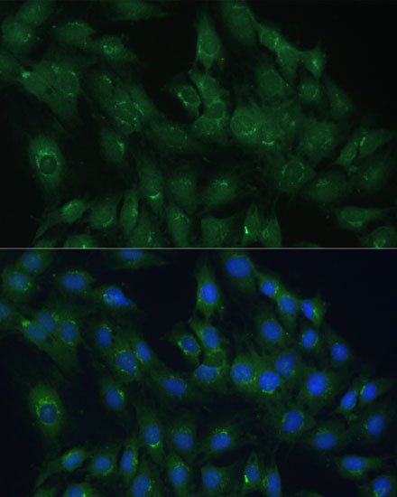 Immunofluorescence analysis of C6 cells using ARL1 Polyclonal Antibody at dilution of  1:100 (40x lens). Blue: DAPI for nuclear staining.