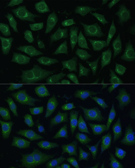 Immunofluorescence analysis of L929 cells using ARL1 Polyclonal Antibody at dilution of  1:100 (40x lens). Blue: DAPI for nuclear staining.