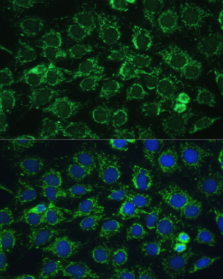 Immunofluorescence analysis of C6 cells using ATP5C1 Polyclonal Antibody at dilution of  1:100 (40x lens). Blue: DAPI for nuclear staining.