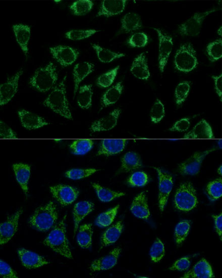 Immunofluorescence analysis of L929 cells using ATP5C1 Polyclonal Antibody at dilution of  1:100 (40x lens). Blue: DAPI for nuclear staining.