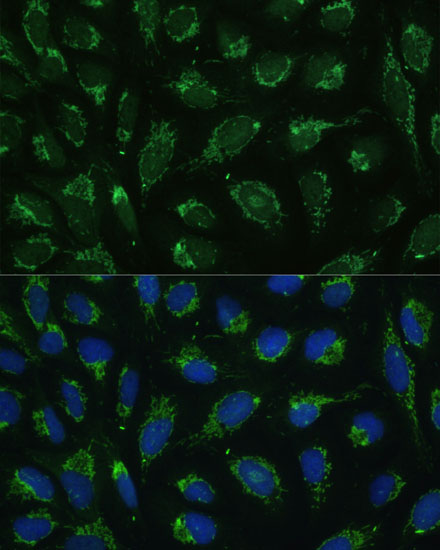 Immunofluorescence analysis of U-2 OS cells using ATP5C1 Polyclonal Antibody at dilution of  1:100 (40x lens). Blue: DAPI for nuclear staining.