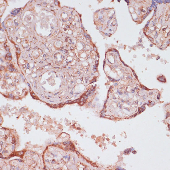 Immunohistochemistry of paraffin-embedded Human placenta using ATP5C1 Polyclonal Antibody at dilution of  1:100 (40x lens).