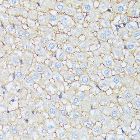 Immunohistochemistry of paraffin-embedded Rat liver using CTNNA2 Polyclonal Antibody at dilution of  1:100 (40x lens).