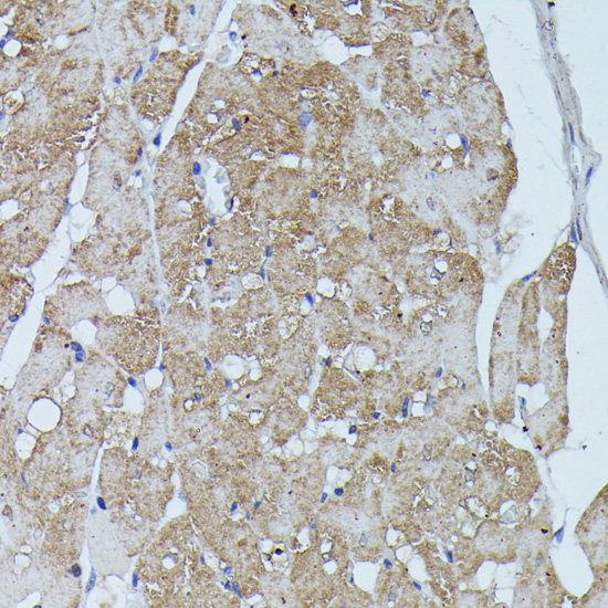 Immunohistochemistry of paraffin-embedded Rat heart using FLII Polyclonal Antibody at dilution of  1:100 (40x lens).