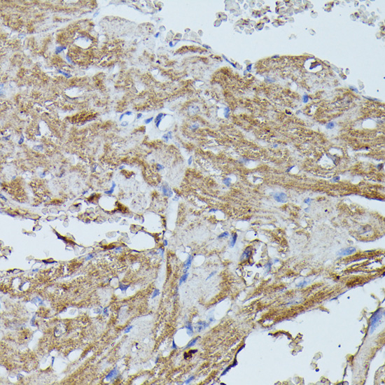 Immunohistochemistry of paraffin-embedded Mouse heart using FLII Polyclonal Antibody at dilution of  1:100 (40x lens).