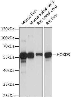 Western blot analysis of extracts of various cell lines using HOXD3 Polyclonal Antibody at dilution of 1:1000.