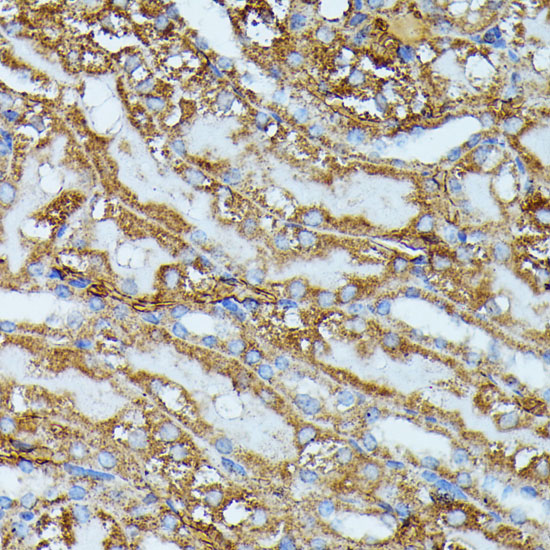 Immunohistochemistry of paraffin-embedded Mouse kidney using IVD Polyclonal Antibody at dilution of  1:100 (40x lens).