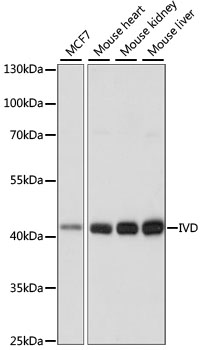 Western blot analysis of extracts of various cell lines using IVD Polyclonal Antibody at dilution of 1:1000.