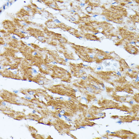 Immunohistochemistry of paraffin-embedded Rat heart using KCNJ15 Polyclonal Antibody at dilution of  1:100 (40x lens).