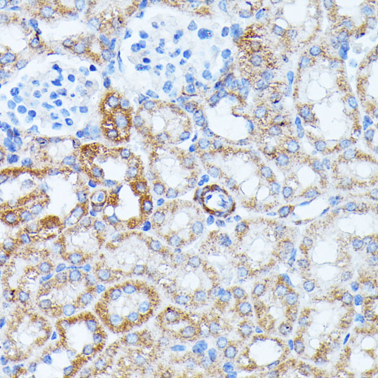 Immunohistochemistry of paraffin-embedded Mouse kidney using KCNJ15 Polyclonal Antibody at dilution of  1:100 (40x lens).