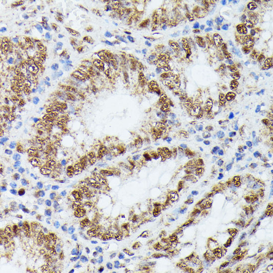 Immunohistochemistry of paraffin-embedded Human colon using KIF22 Polyclonal Antibody at dilution of  1:100 (40x lens).