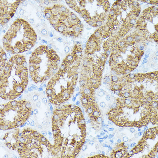 Immunohistochemistry of paraffin-embedded Rat kidney using PLS1 Polyclonal Antibody at dilution of  1:100 (40x lens).