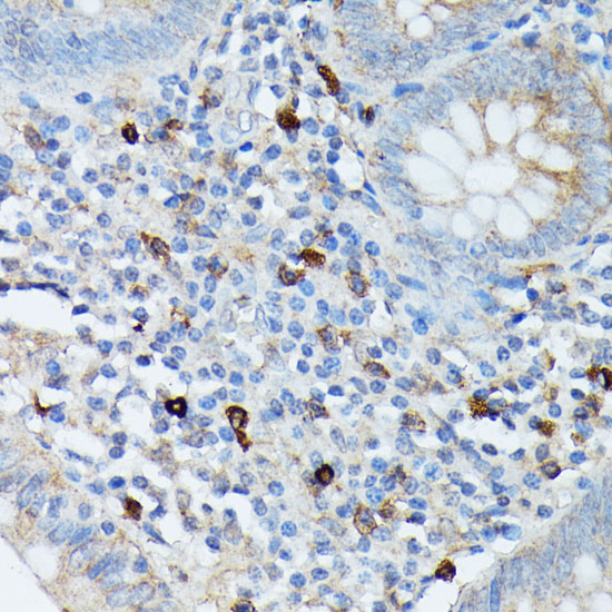 Immunohistochemistry of paraffin-embedded Human appendix using RNASE6 Polyclonal Antibody at dilution of  1:100 (40x lens).