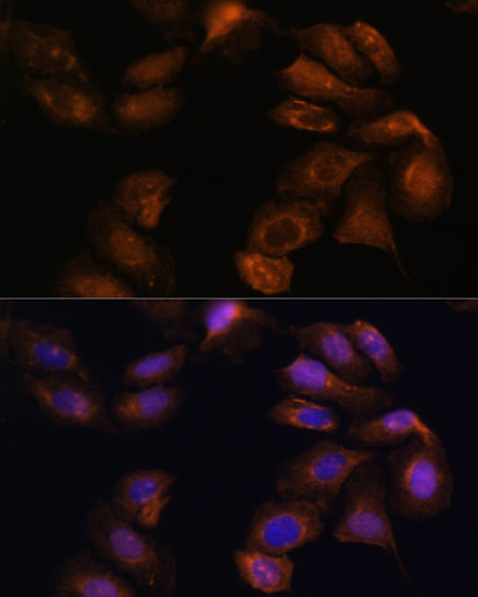 Immunofluorescence analysis of U-2 OS cells using ROBO1 Polyclonal Antibody at dilution of  1:100 (40x lens). Blue: DAPI for nuclear staining.