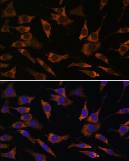 Immunofluorescence analysis of L929 cells using RPS25 Polyclonal Antibody at dilution of  1:100. Blue: DAPI for nuclear staining.