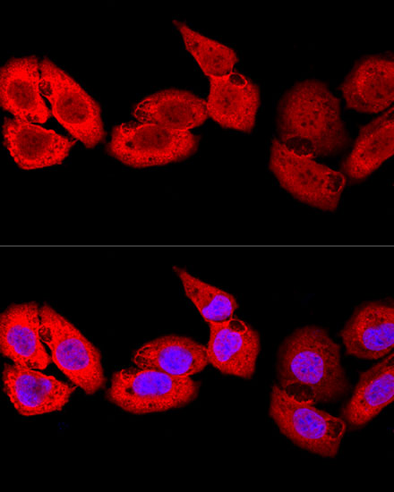 Confocal immunofluorescence analysis of U-2 OS cells using S100A8 Polyclonal Antibody at dilution of  1:100. Blue: DAPI for nuclear staining.