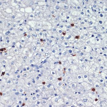 Immunohistochemistry of paraffin-embedded Human liver using S100A8 Polyclonal Antibody at dilution of  1:200 (40x lens).