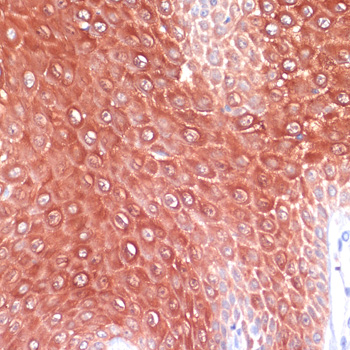 Immunohistochemistry of paraffin-embedded Human skin using S100A8 Polyclonal Antibody at dilution of  1:200 (40x lens).