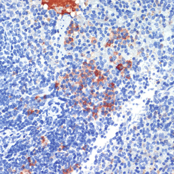 Immunohistochemistry of paraffin-embedded Mouse spleen using S100A8 Polyclonal Antibody at dilution of  1:200 (40x lens).