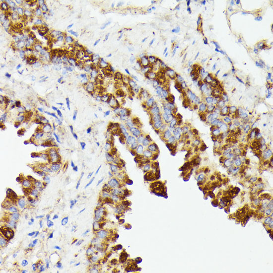 Immunohistochemistry of paraffin-embedded Mouse lung using PTP4A2 Polyclonal Antibody at dilution of  1:100 (40x lens).