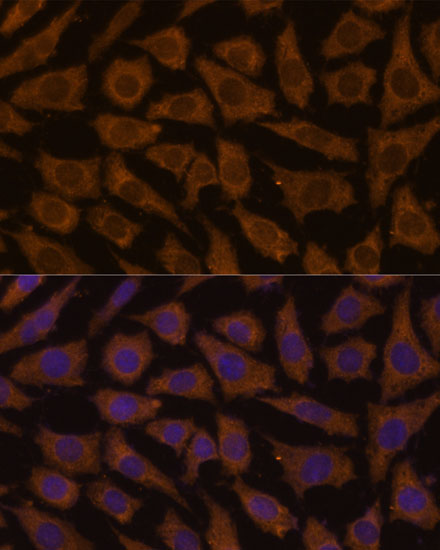 Immunofluorescence analysis of L929 cells using MTMR4 Polyclonal Antibody at dilution of  1:100 (40x lens). Blue: DAPI for nuclear staining.