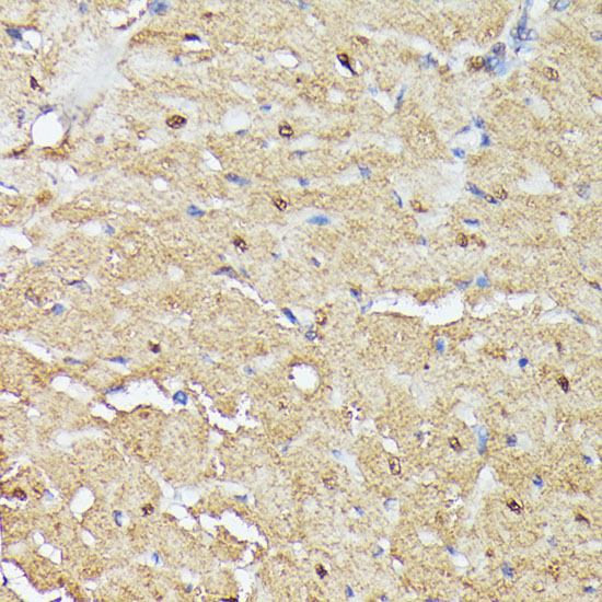 Immunohistochemistry of paraffin-embedded Rat heart using TRIP4 Polyclonal Antibody at dilution of  1:100 (40x lens).