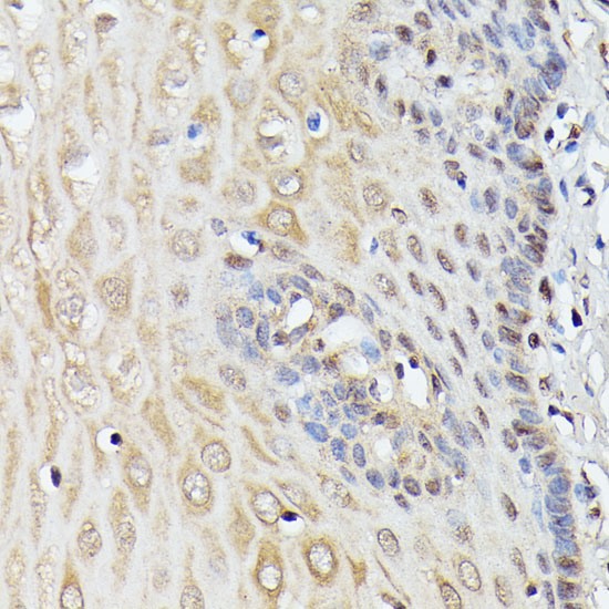 Immunohistochemistry of paraffin-embedded Human esophageal using TRIP4 Polyclonal Antibody at dilution of  1:100 (40x lens).