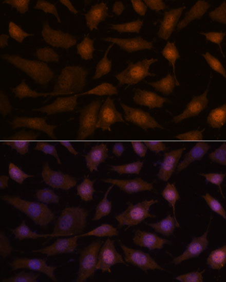 Immunofluorescence analysis of L929 cells using EEF1E1 Polyclonal Antibody at dilution of  1:100. Blue: DAPI for nuclear staining.