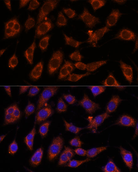 Immunofluorescence analysis of L929 cells using GFPT2 Polyclonal Antibody at dilution of  1:100. Blue: DAPI for nuclear staining.