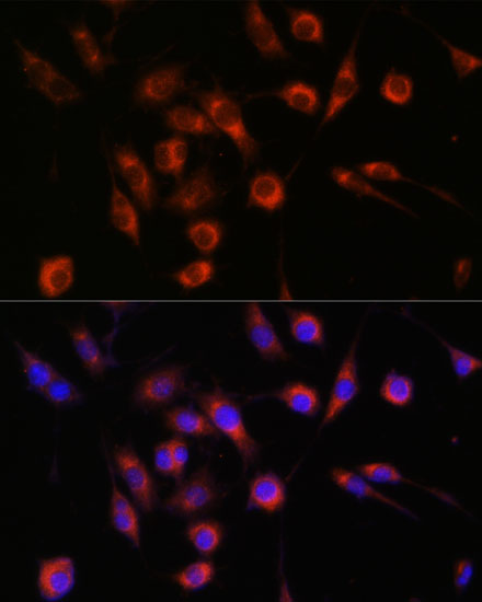 Immunofluorescence analysis of L929 cells using COL4A3BP Polyclonal Antibody at dilution of  1:100. Blue: DAPI for nuclear staining.