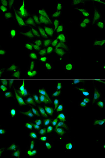 Immunofluorescence analysis of MCF-7 cells using PSMC5 Polyclonal Antibody