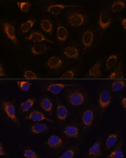 Immunofluorescence analysis of U-2 OS cells using TCIRG1 Polyclonal Antibody at dilution of  1:100 (40x lens). Blue: DAPI for nuclear staining.