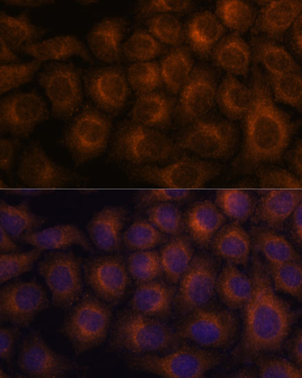 Immunofluorescence analysis of HeLa cells using VAV3 Polyclonal Antibody at dilution of  1:100. Blue: DAPI for nuclear staining.