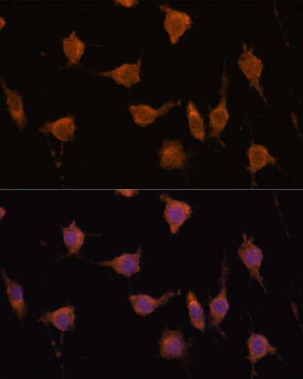 Immunofluorescence analysis of L929 cells using VAV3 Polyclonal Antibody at dilution of  1:100. Blue: DAPI for nuclear staining.