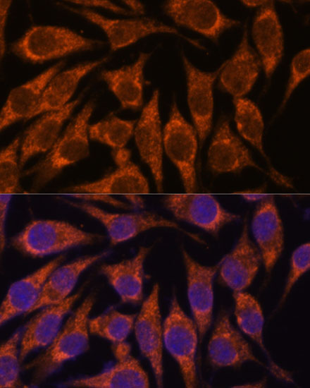 Immunofluorescence analysis of L929 cells using SEMA3C Polyclonal Antibody at dilution of  1:100. Blue: DAPI for nuclear staining.