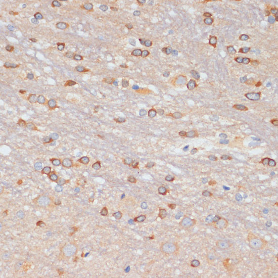 Immunohistochemistry of paraffin-embedded Rat brain using NFAT2 Polyclonal Antibody at dilution of  1:100 (40x lens).