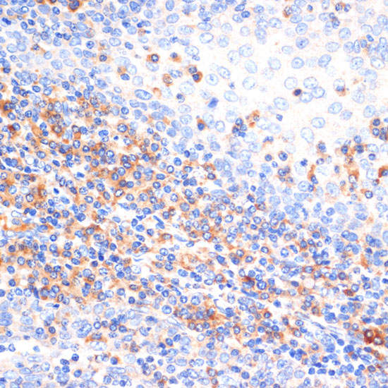 Immunohistochemistry of paraffin-embedded Human tonsil using NFAT2 Polyclonal Antibody at dilution of  1:100 (40x lens).