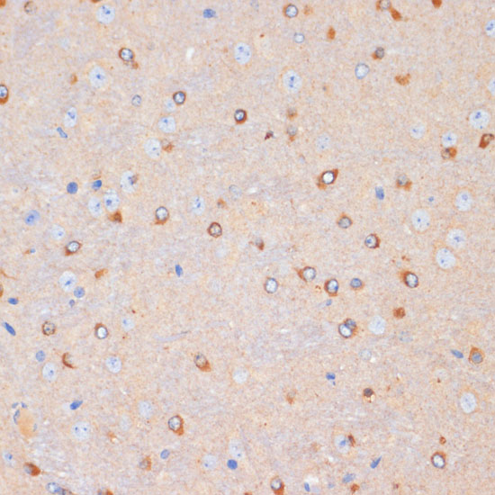 Immunohistochemistry of paraffin-embedded Mouse brain using NFAT2 Polyclonal Antibody at dilution of  1:100 (40x lens).