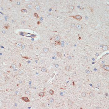 Immunohistochemistry of paraffin-embedded Rat brain using AFG3L2 Polyclonal Antibody at dilution of  1:200 (40x lens).