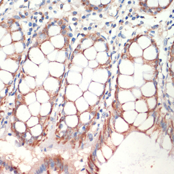 Immunohistochemistry of paraffin-embedded Human colon using AFG3L2 Polyclonal Antibody at dilution of  1:200 (40x lens).